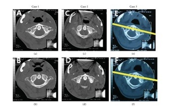 SCIE Paper CT Scan Evidence